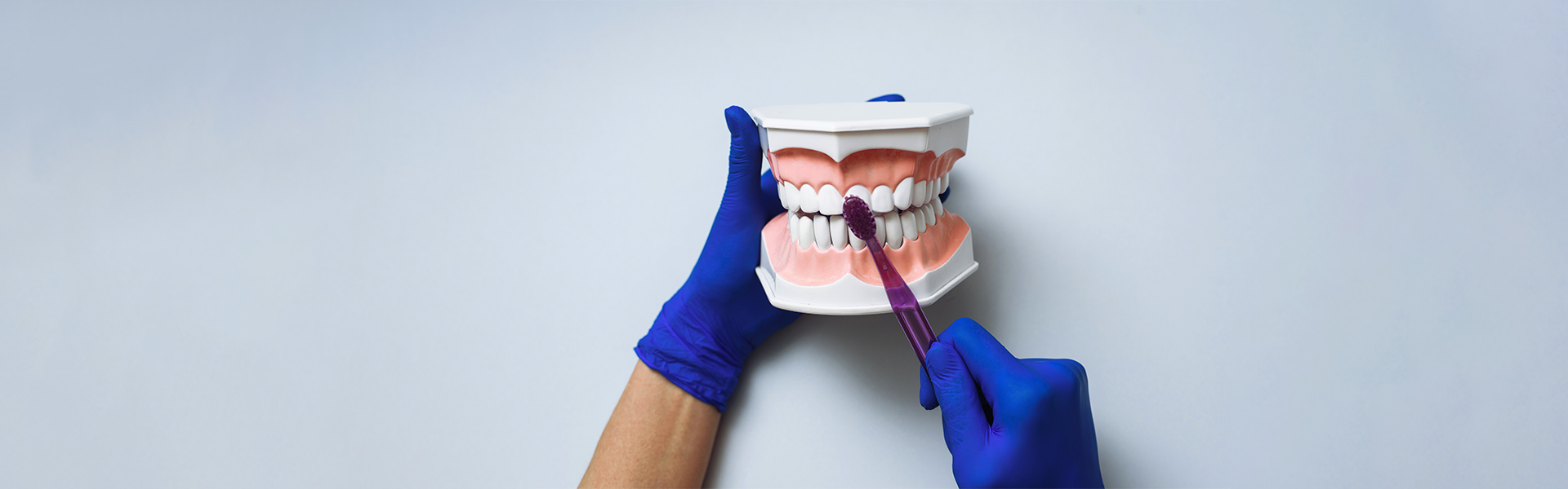 Dentist using dental model to explain implants vs bridges in Cambridge