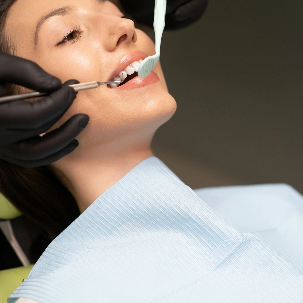 Composite Filling Treatment at Dental Art Clinic in Cambridge