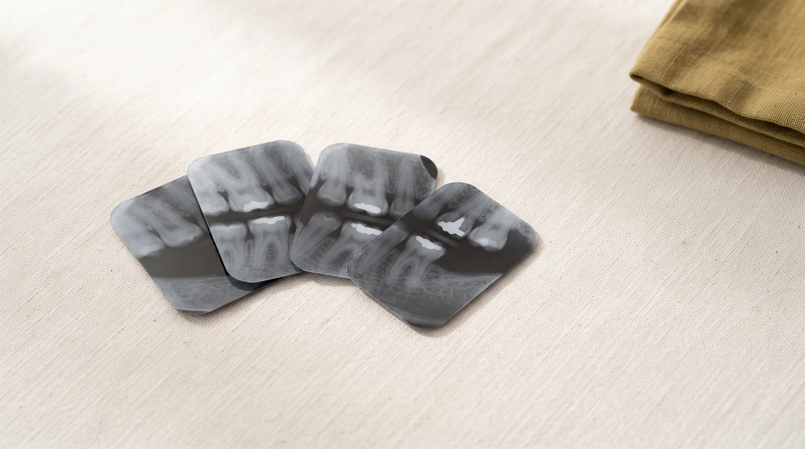Four small bitewing dental x-ray films fanned across linen