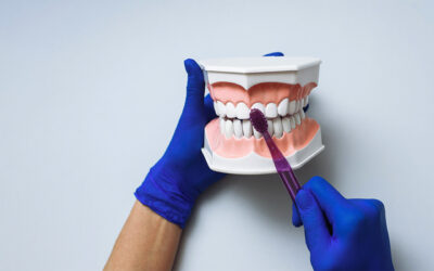 Dental Implants vs. Bridges – Which One is For You?