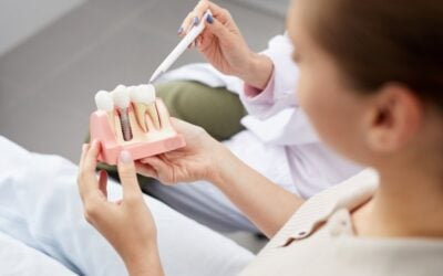 How Much Do Dental Implants Cost in Cambridge, Ontario?